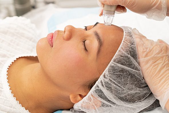 Microdermabrasion Treatment