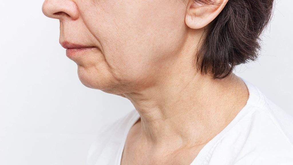 Chin Sculpting Treatment weak receding chin